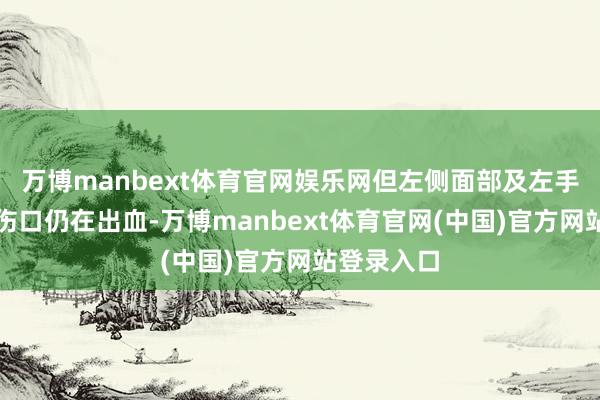 万博manbext体育官网娱乐网但左侧面部及左手各有一处伤口仍在出血-万博manbext体育官网(中国)官方网站登录入口